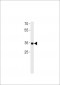 RHOXF2B Antibody (Center)